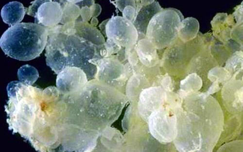 ���г��ڳ�Ѫ����ô���� �����ڳ�Ѫ��ԭ��